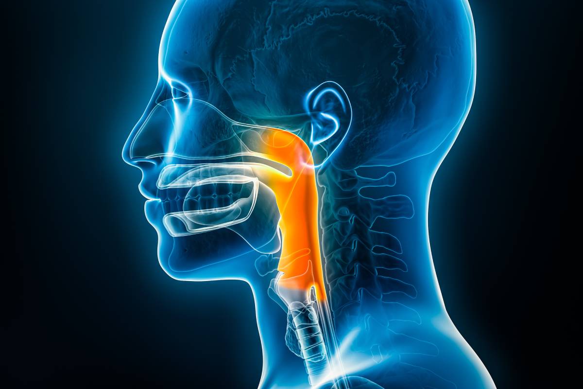 Anatomy of Difficult Airways 