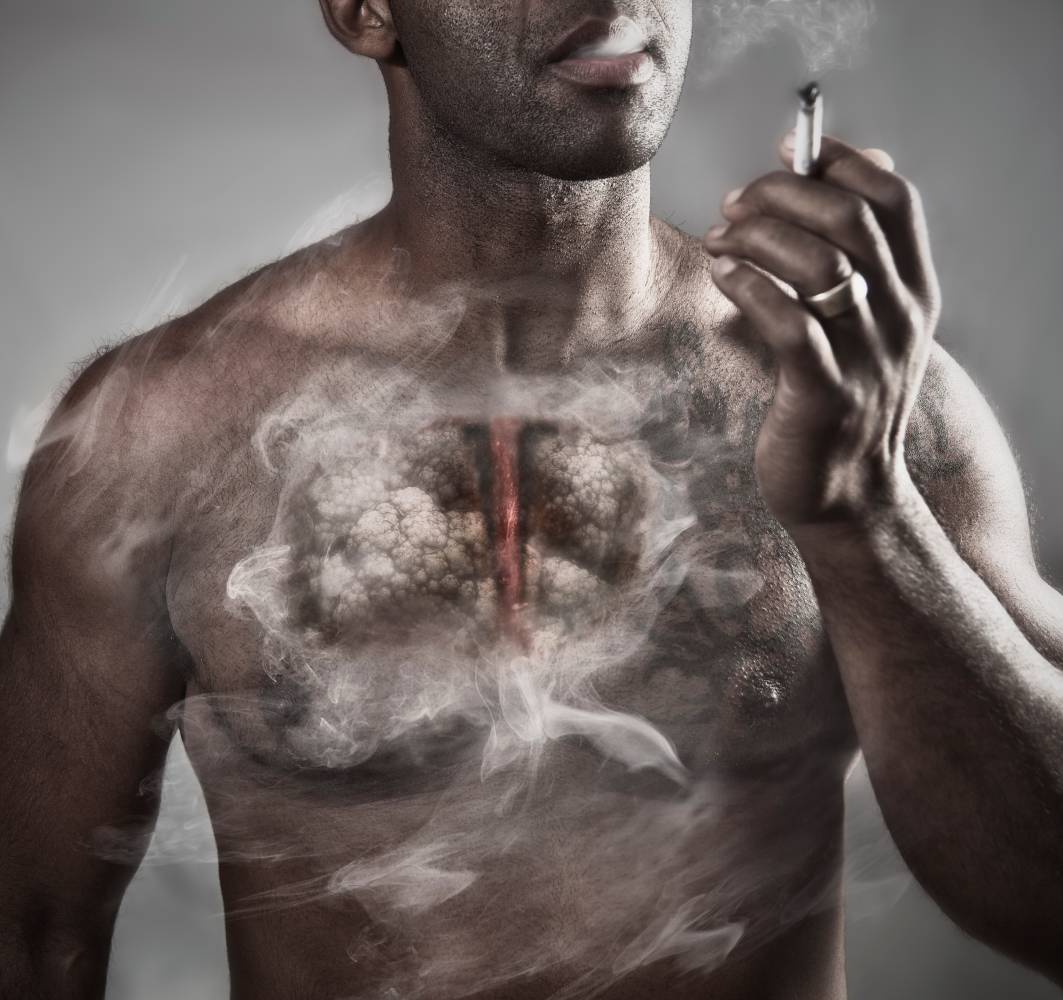 Anesthesia Considerations for Patients with Emphysema 