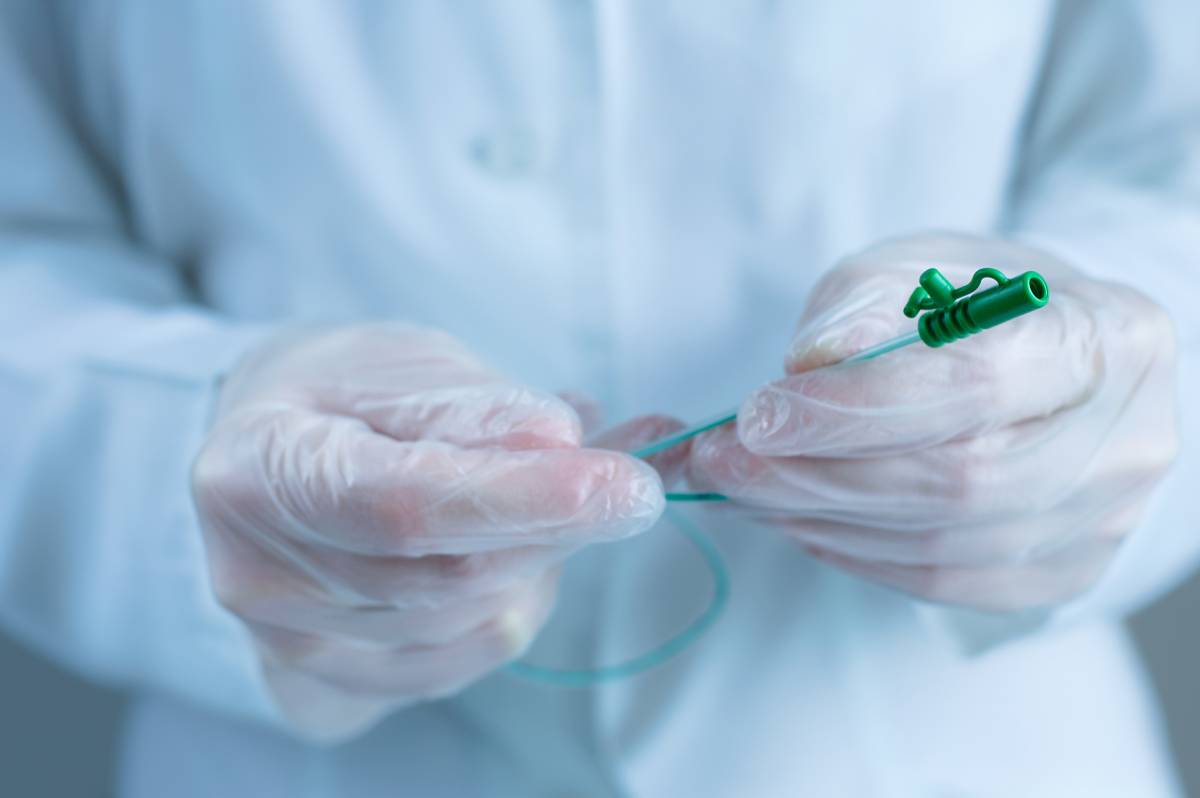 Catheter Migration in Continuous Nerve Blocks